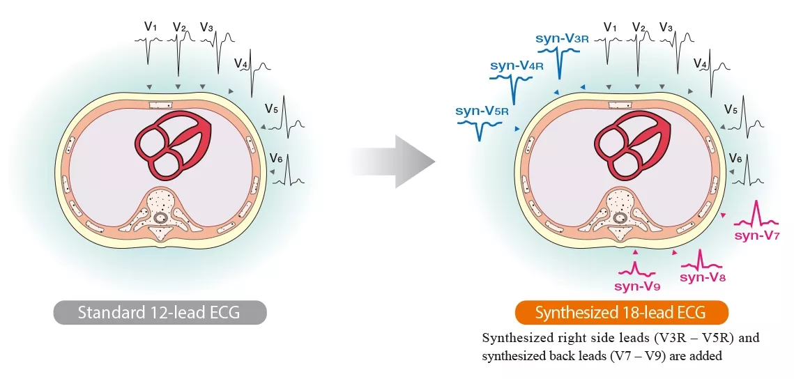 image syneci18 01